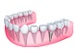 Dental Equipment