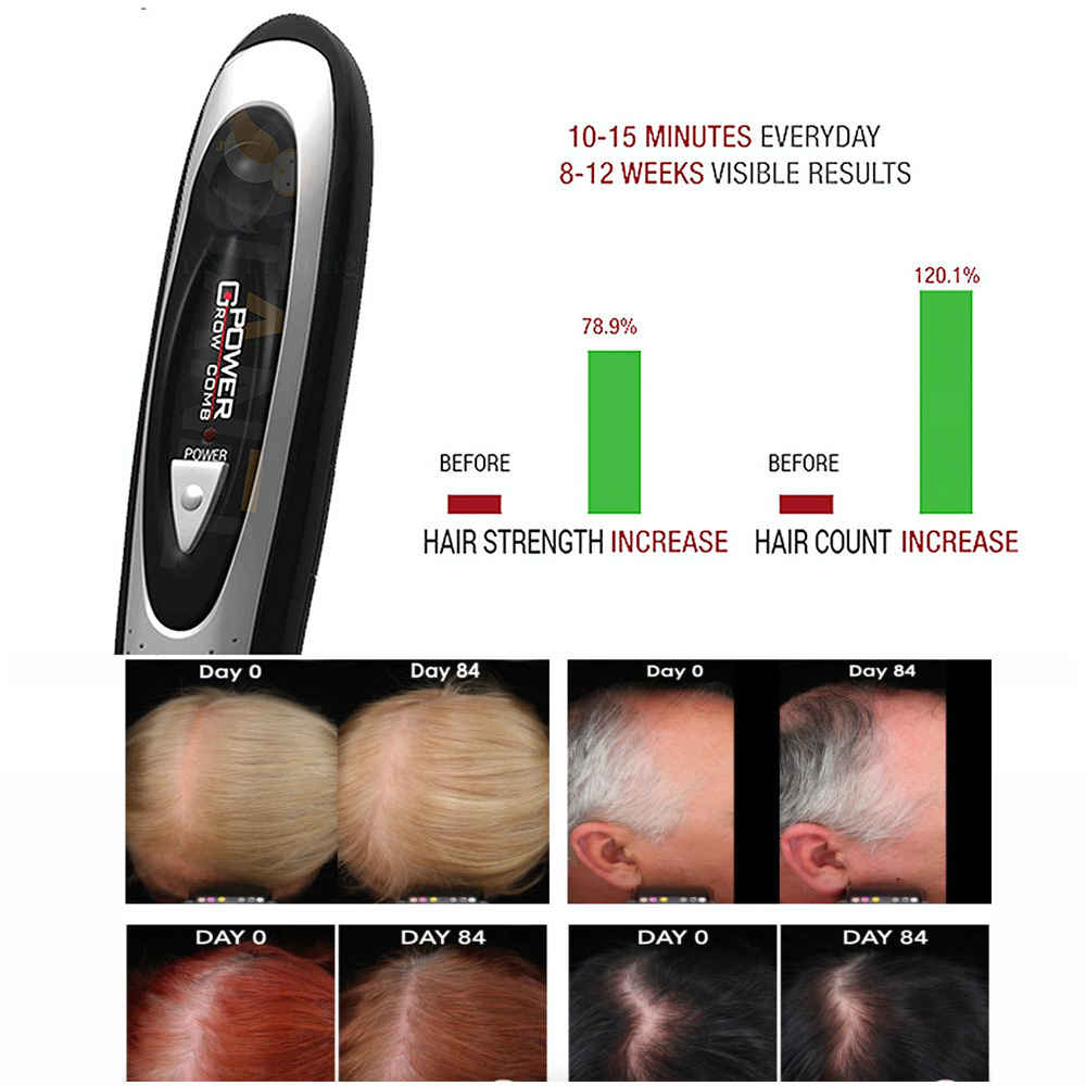Laser Comb Brush Hair Loss Hair Growth Treatment Kit Price, Specification,  Review in Bangladesh 2023